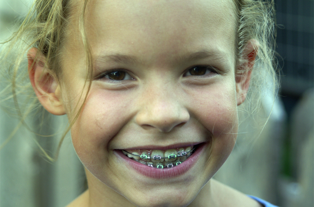 Child with colored braces